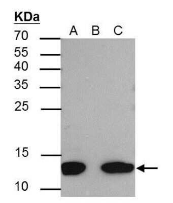 Immunoprecipitation: Histone H4 [ac Lys8] Antibody [NBP2-42863]